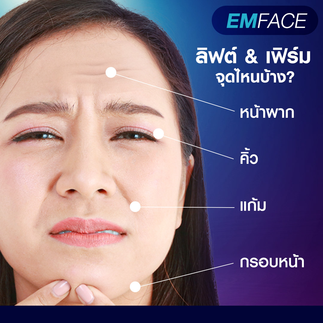 Emface, ยกกระชับผิว, ยกกระชับหน้าเด็ก, ยกผิว