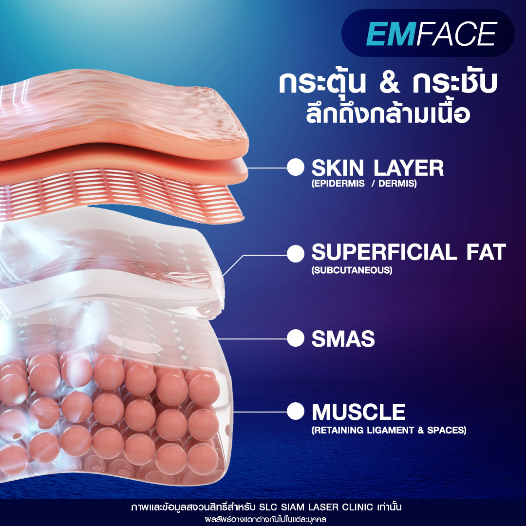 Emface, ยกกระชับผิว, ยกกระชับหน้าเด็ก, ยกผิว