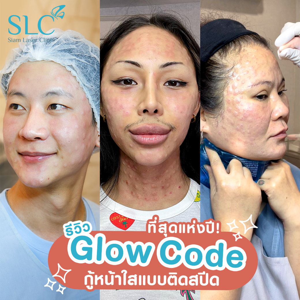 Glow Code_หน้าใส_ลดใต้ตาดำ_ผิวอิ่มน้ำ