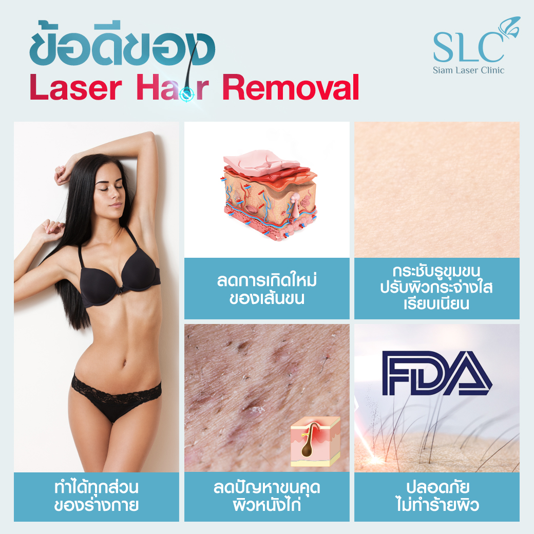 เลเซอร์กำจัดขน_Laser Hair Removal