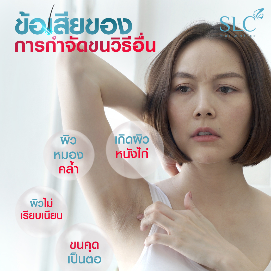 เลเซอร์กำจัดขน_Laser Hair Removal