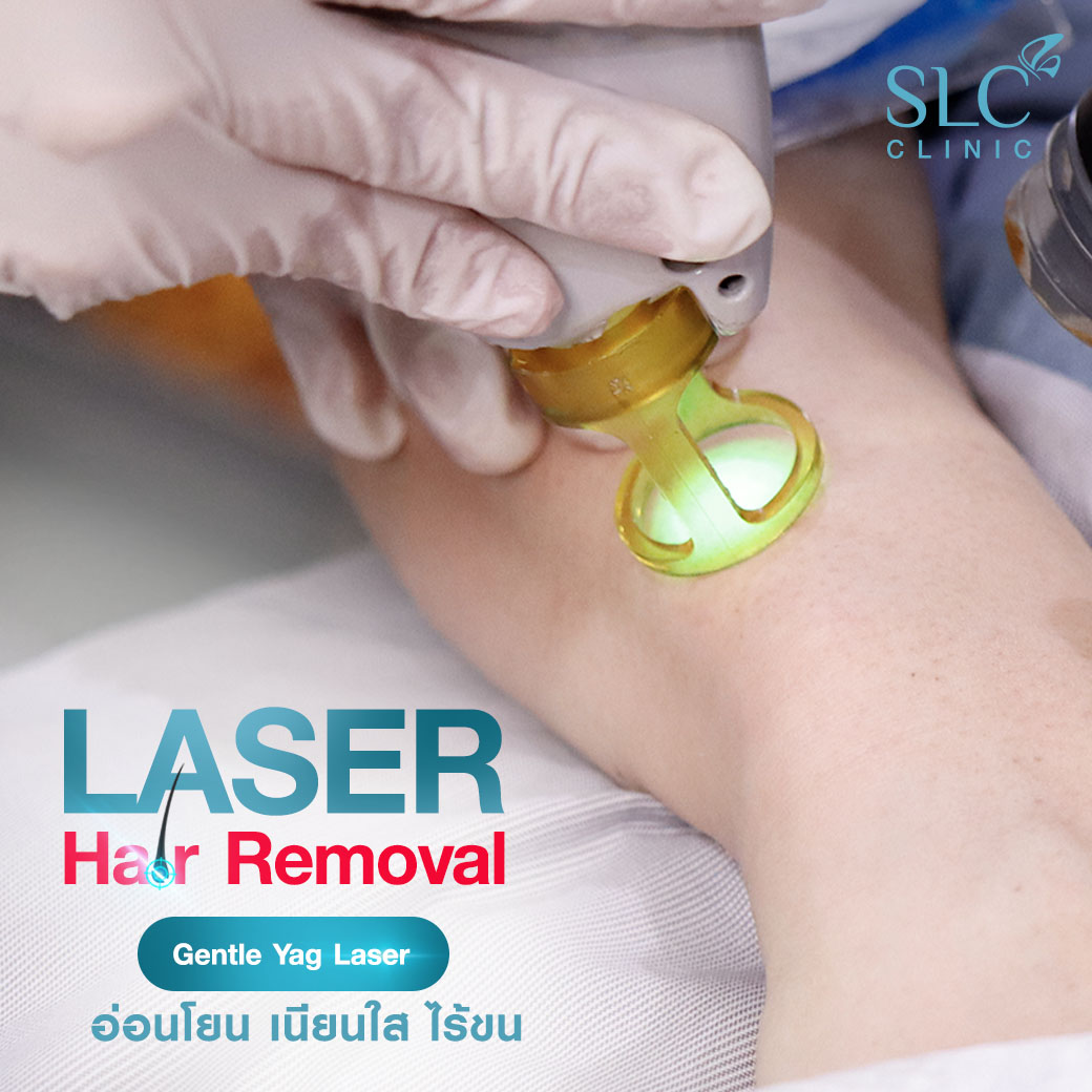 เลเซอร์กำจัดขน_Laser Hair Removal