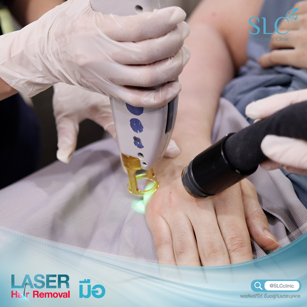 เลเซอร์กำจัดขน_Laser Hair Removal