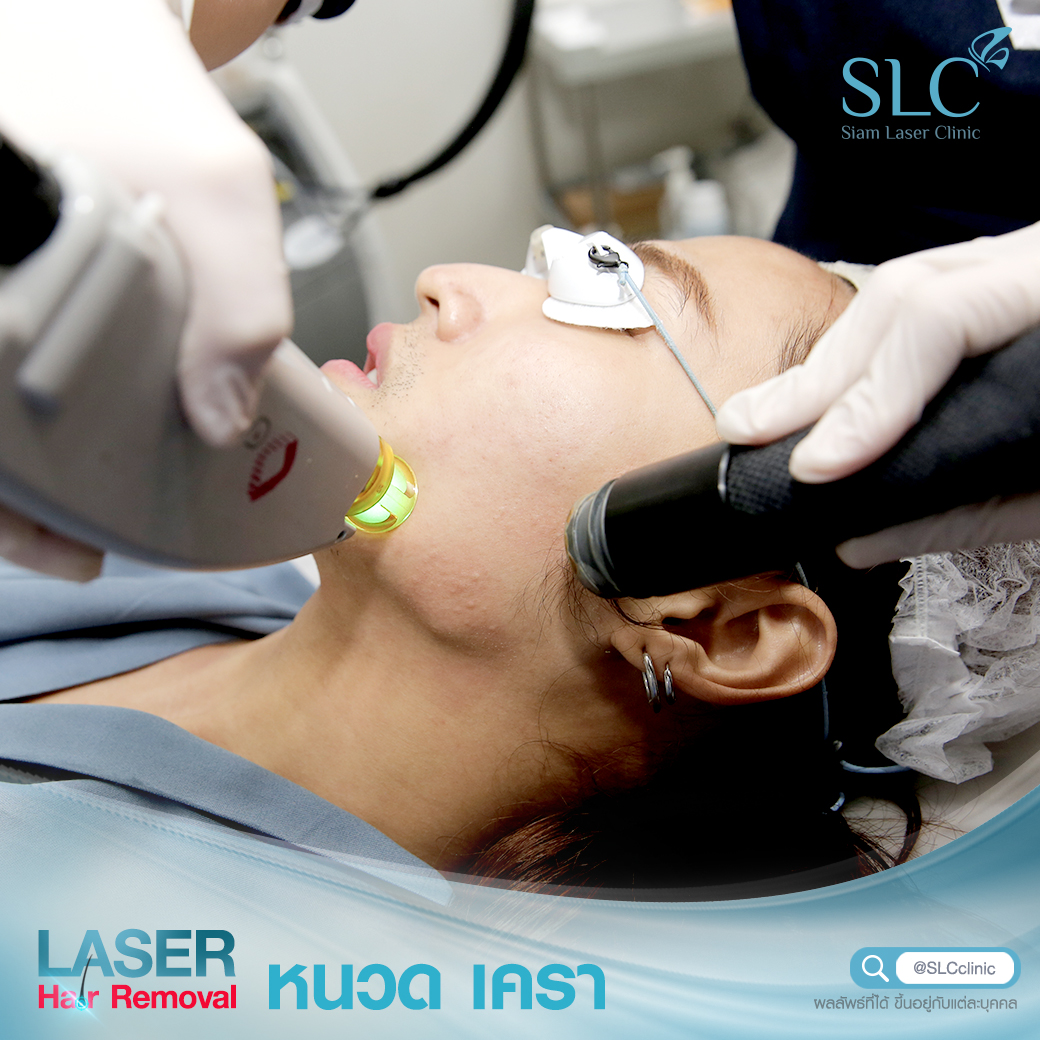 เลเซอร์กำจัดขน_Laser Hair Removal