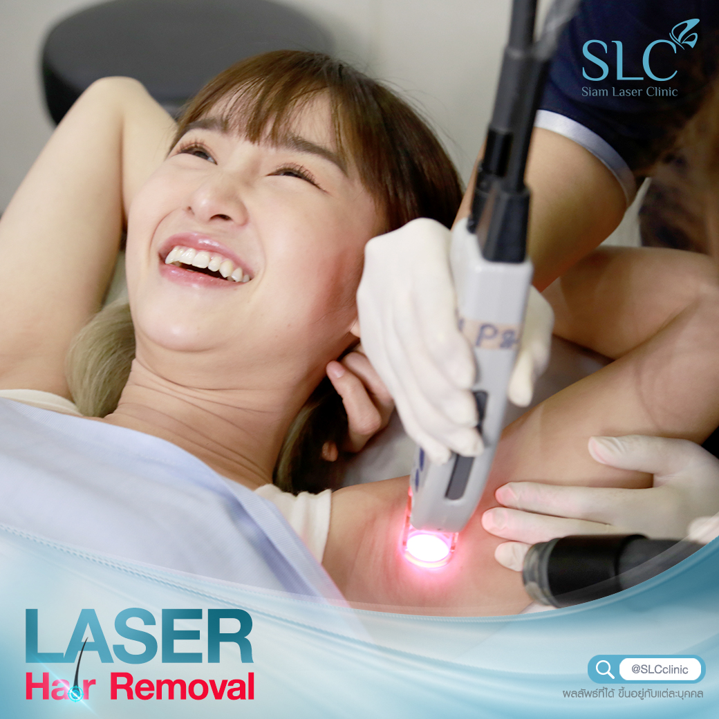 เลเซอร์กำจัดขน_Laser Hair Removal