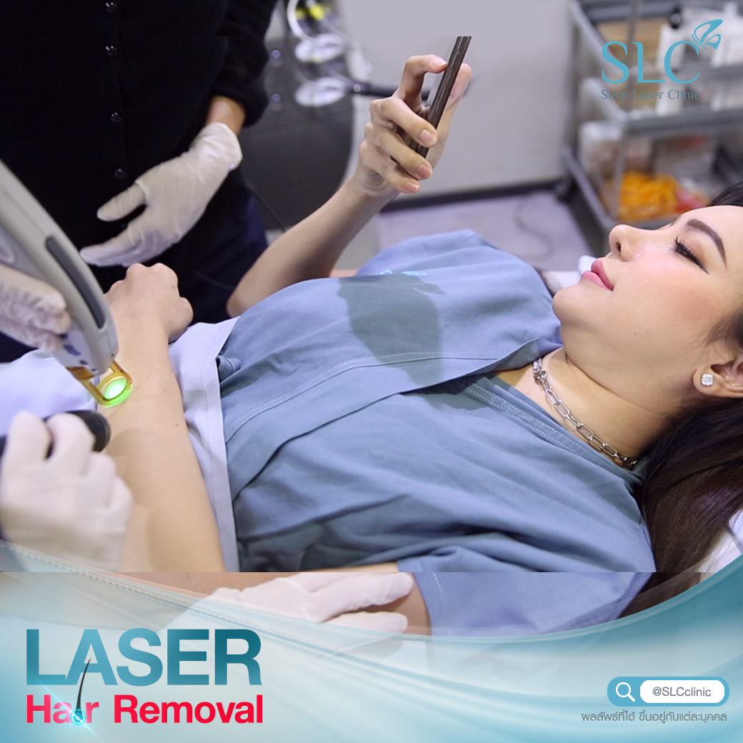 เลเซอร์กำจัดขน_Laser Hair Removal