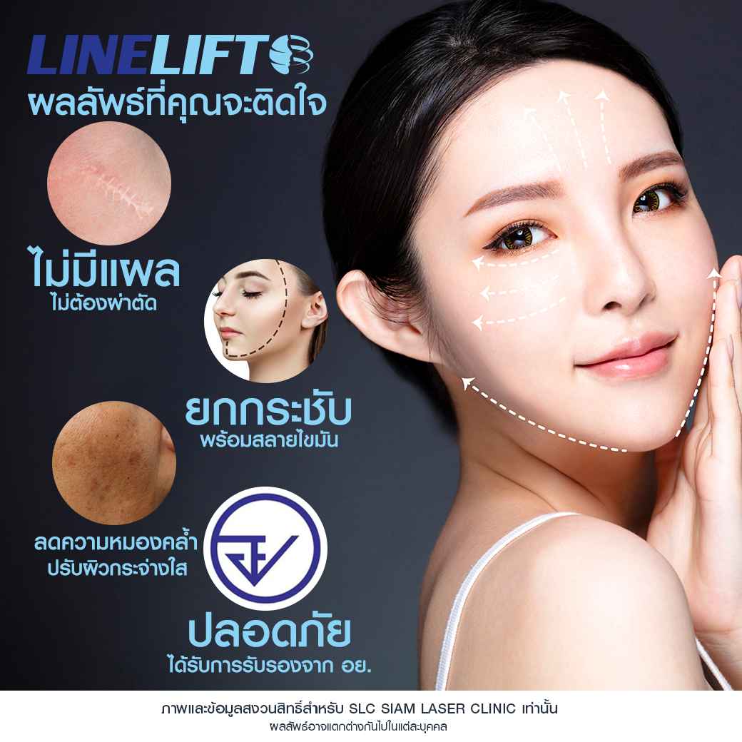 ยกกระชับ Linelift