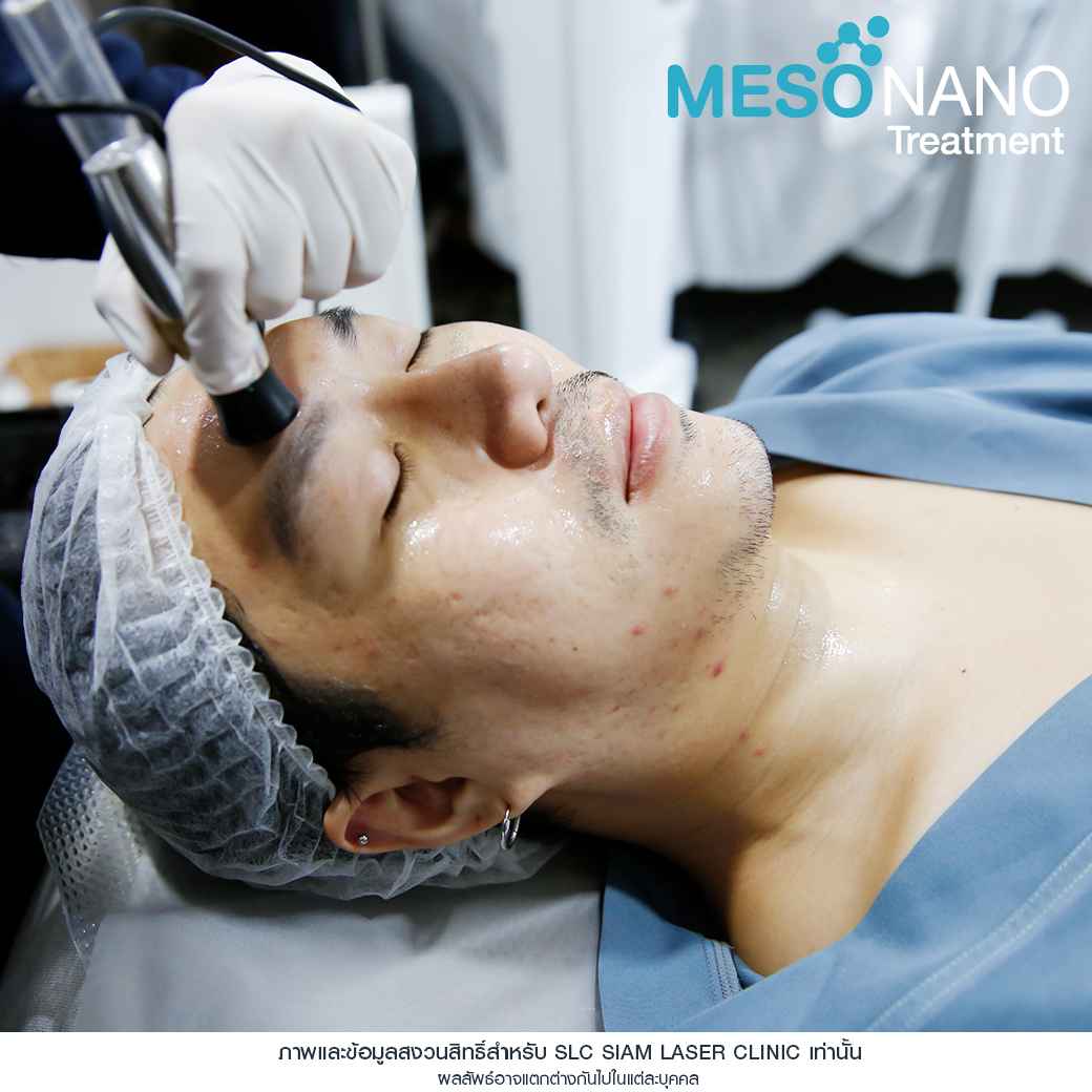 Meso Nano Treatment_เมโสหน้าใส_ทรีทเมนท์หน้าใส