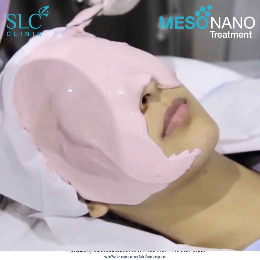 Meso Nano Treatment_เมโสหน้าใส_ทรีทเมนท์หน้าใส