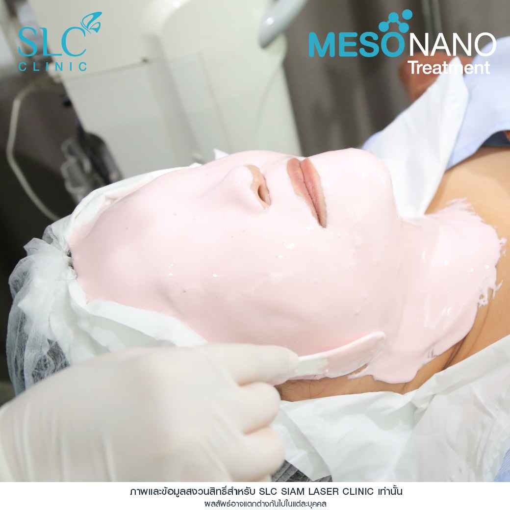 Meso Nano Treatment_เมโสหน้าใส_ทรีทเมนท์หน้าใส