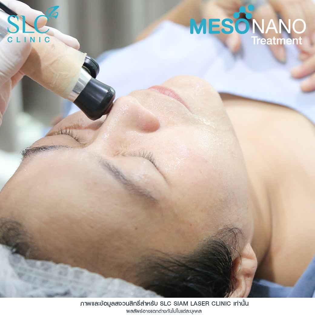 Meso Nano Treatment_เมโสหน้าใส_ทรีทเมนท์หน้าใส