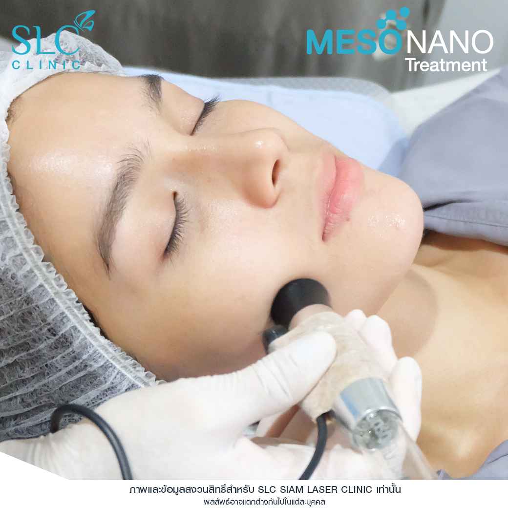 Meso Nano Treatment_เมโสหน้าใส_ทรีทเมนท์หน้าใส