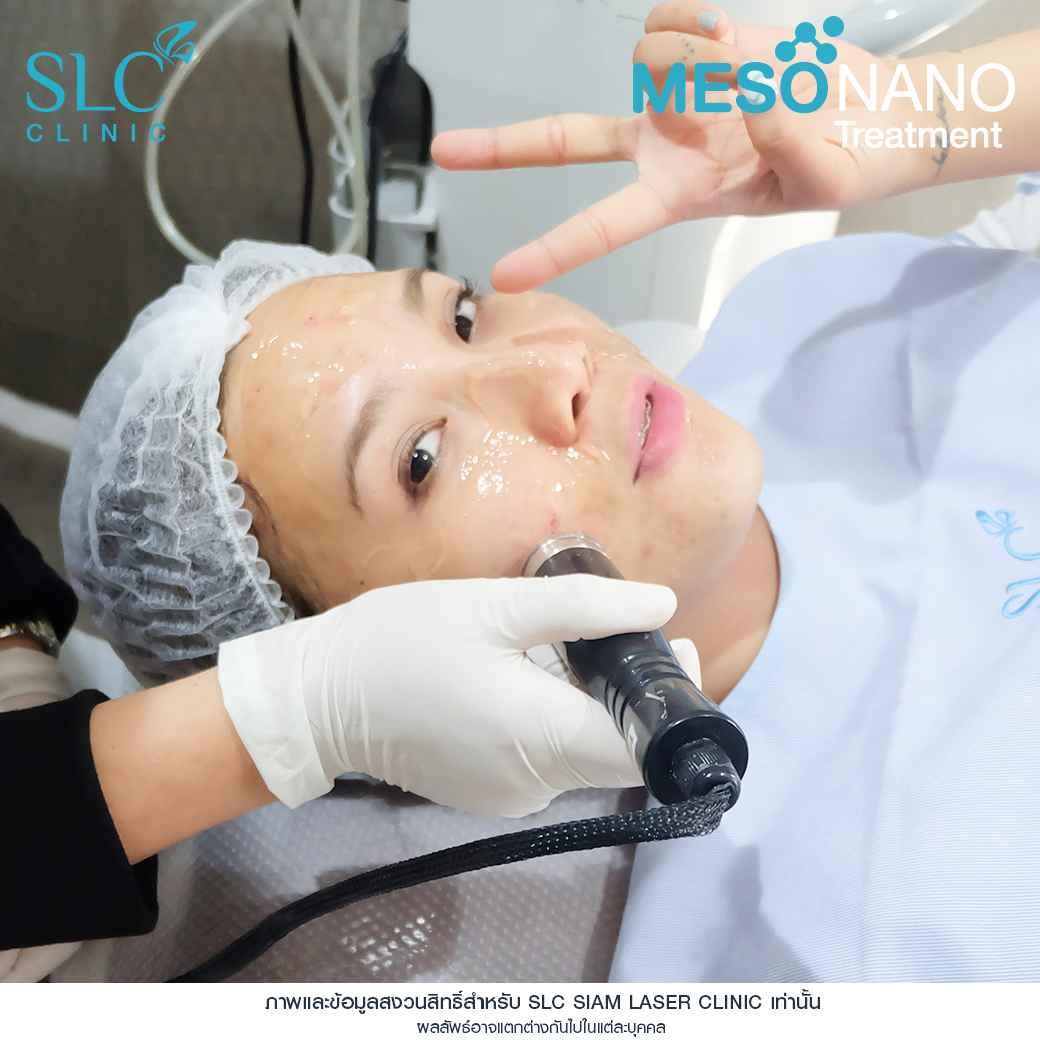 Meso Nano Treatment_เมโสหน้าใส_ทรีทเมนท์หน้าใส