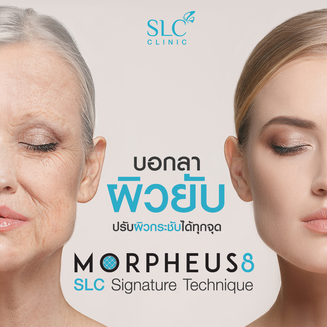 Morpheus8_ยกกระชับ_มอร์เฟียสเอท_Morpheus 8 SLC Signature Technique