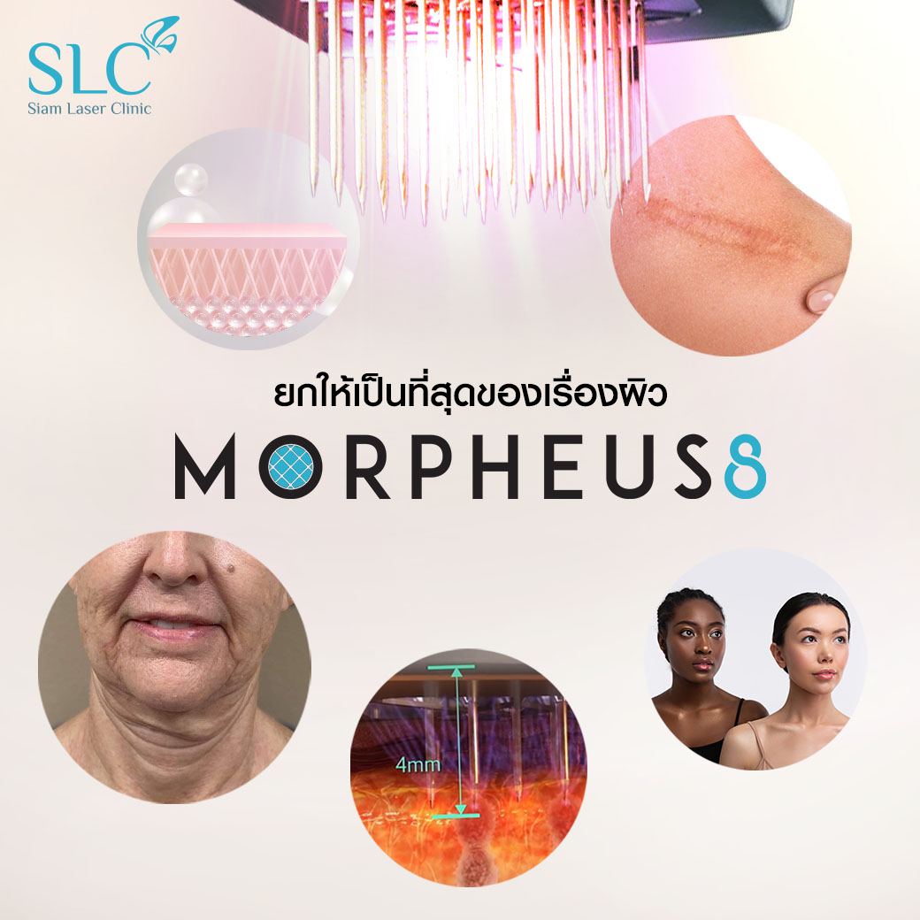 Morpheus8_ยกกระชับ_มอร์เฟียสเอท