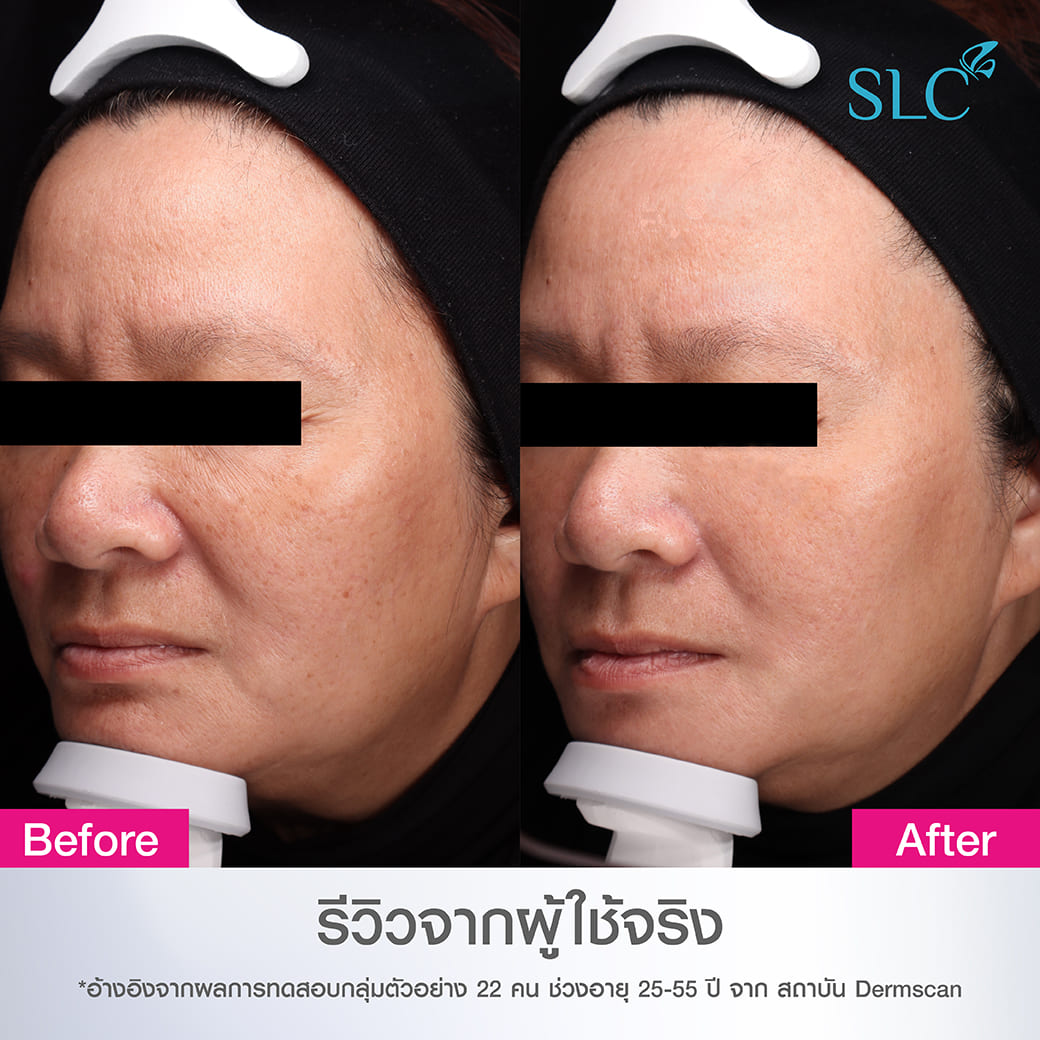 SLC 7 Peptides-Hya Intensive Serum ซีรั่มลดริ้วรอย เซรั่มหน้าเด็ก ยกกระชับผิว ลดฝ้า กระ 