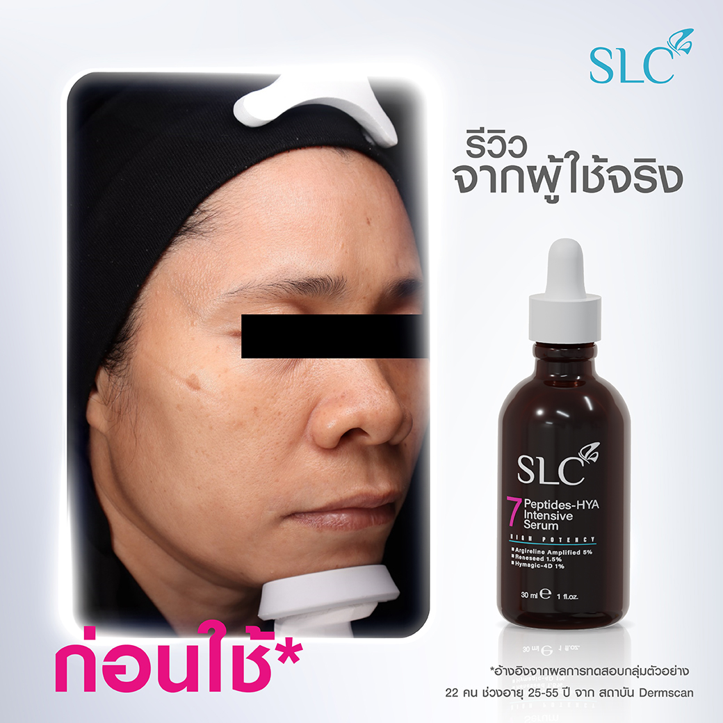 SLC 7 Peptides-Hya Intensive Serum ซีรั่มลดริ้วรอย เซรั่มหน้าเด็ก ยกกระชับผิว ลดฝ้า กระ 