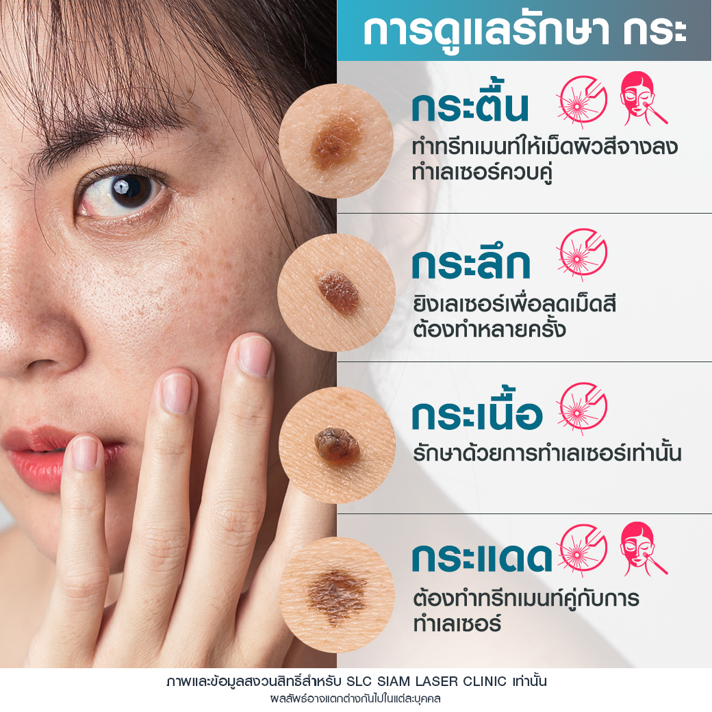 Rejuvenate Laser Brightening_เลเซอร์หน้าใส ลดฝ้า กระ จุดด่างดำ 