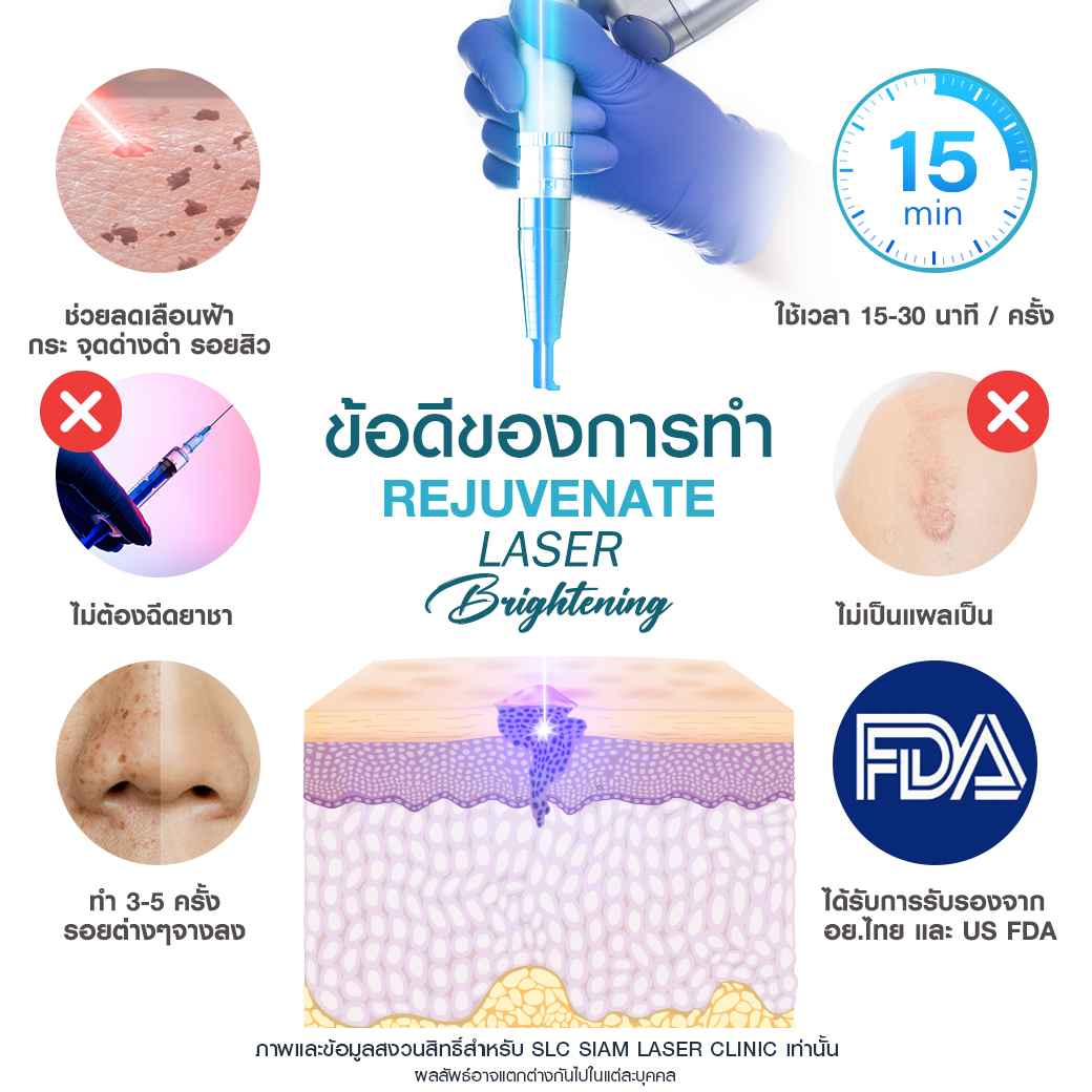 Rejuvenate Laser Brightening_เลเซอร์หน้าใส ลดฝ้า กระ จุดด่างดำ 