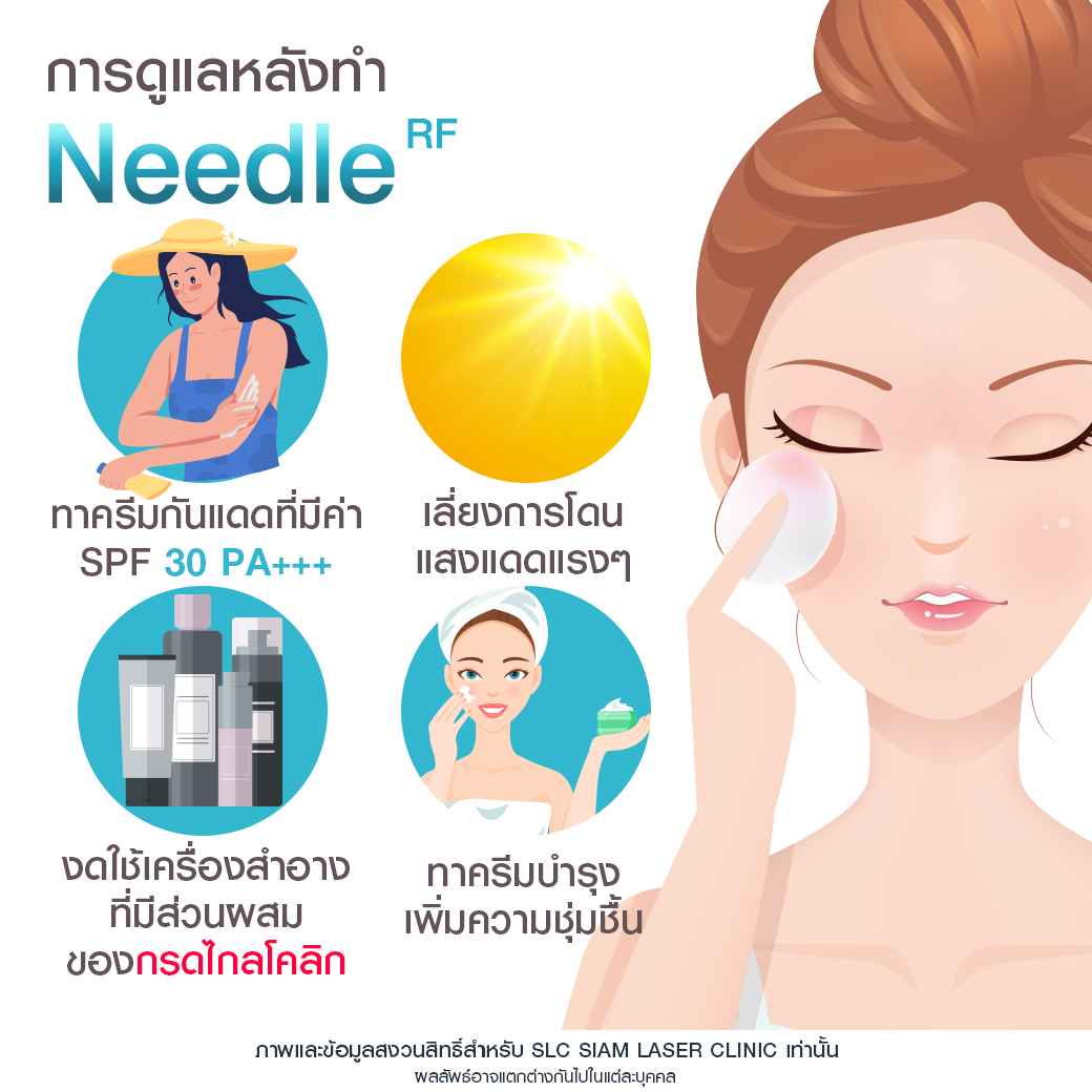 Needle RF_รักษาหลุมสิว_รักษาสิว_ลดริ้วรอย