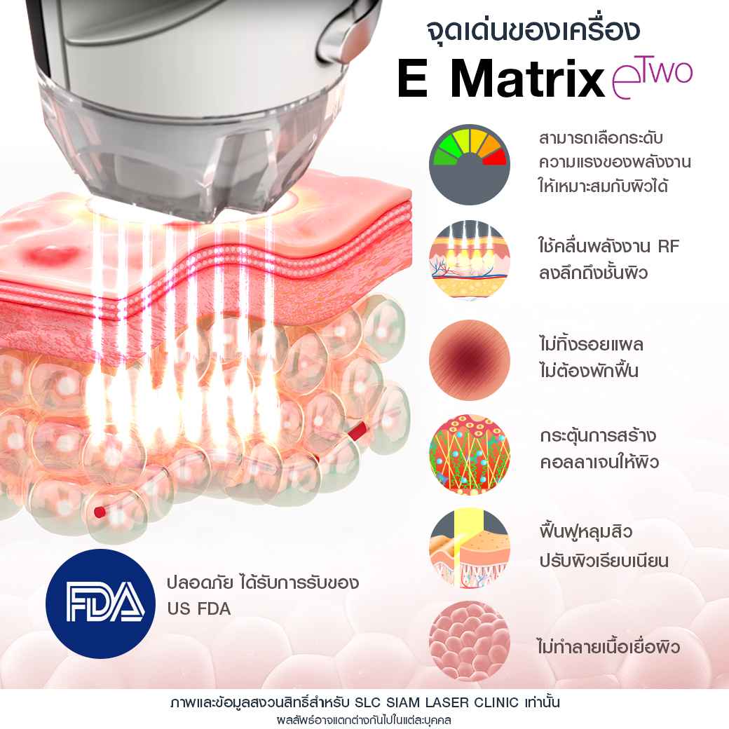 E Matrix ETWO_รักษาหลุมสิว_รักษาสิว_หลุมสิว