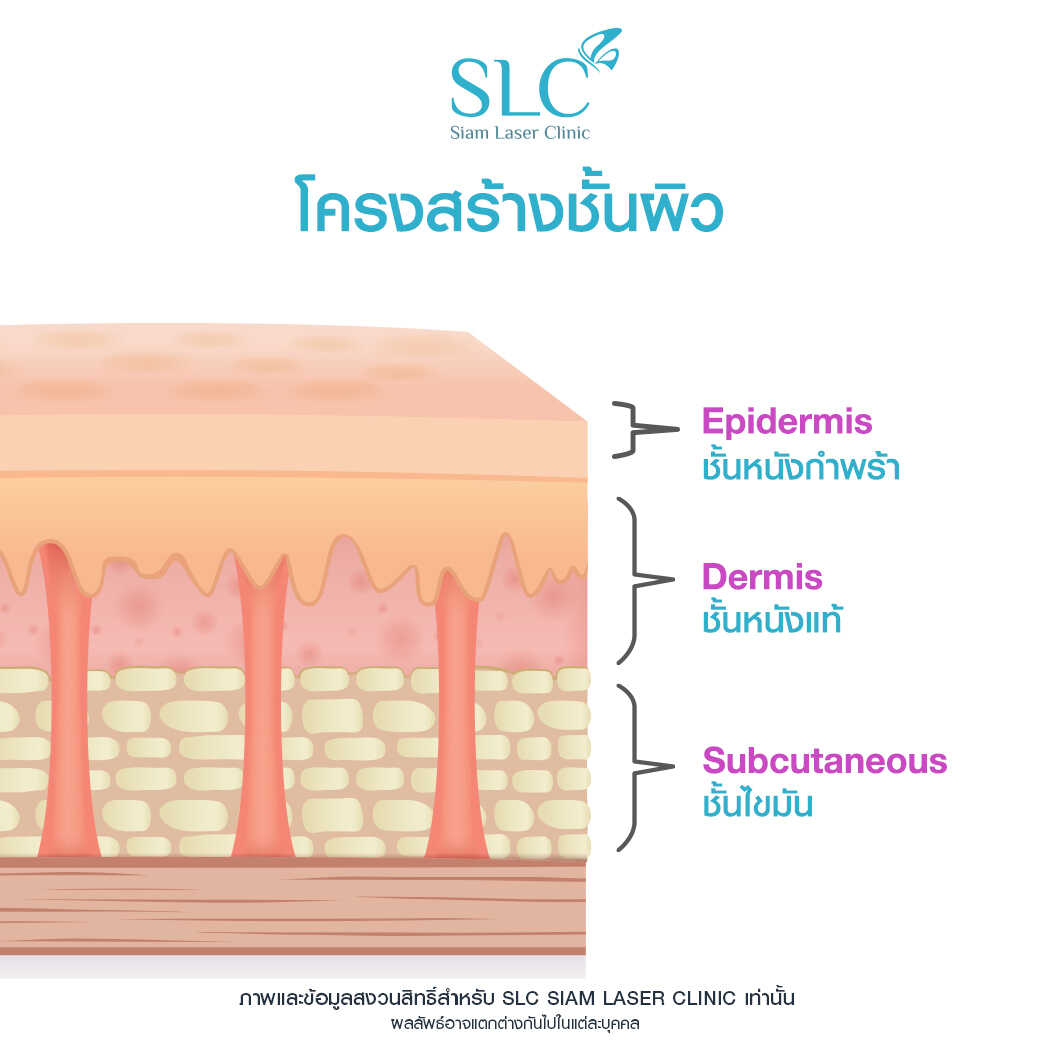 ยกกระชับ Thermage FLX