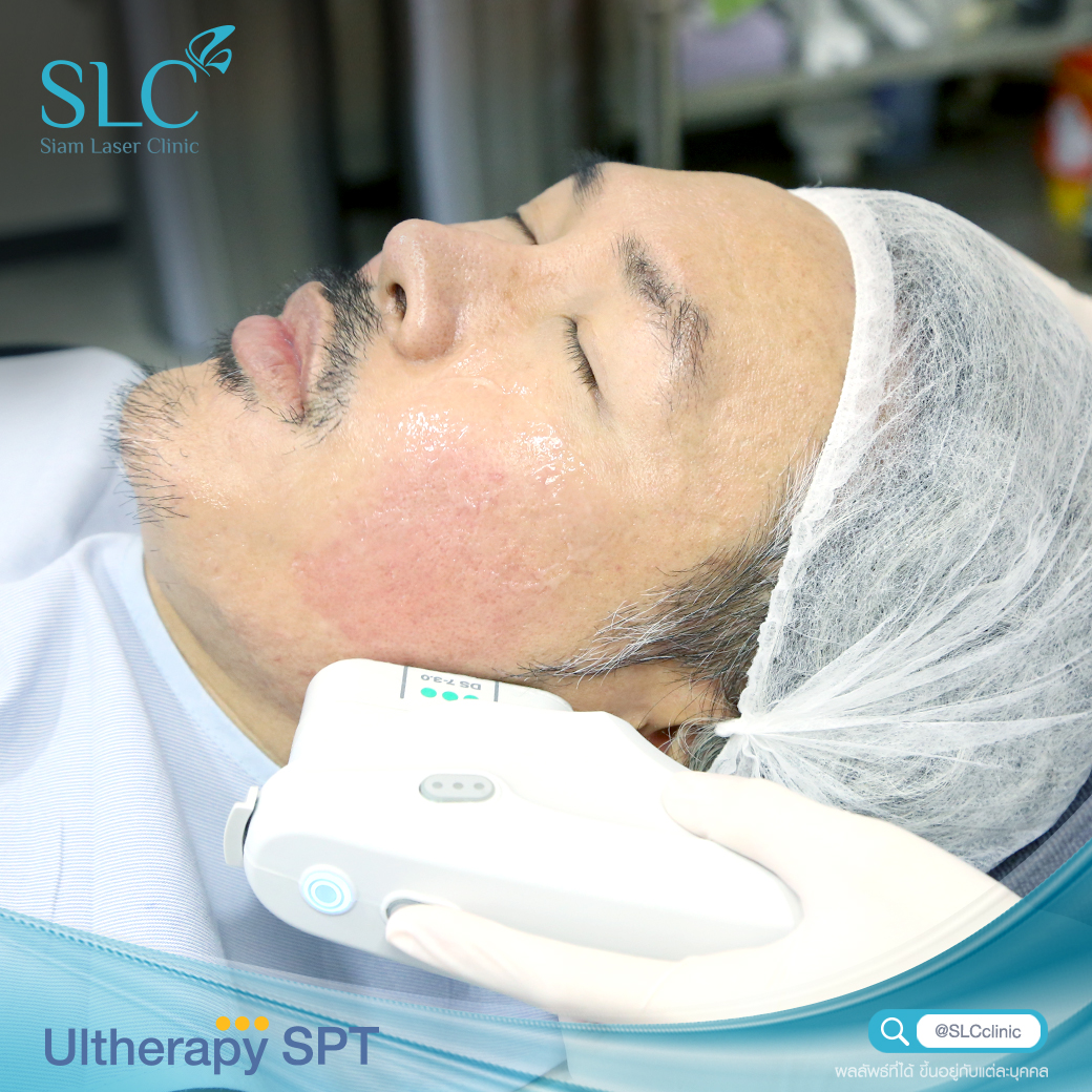 Ultherapy SPT ยกกระชับ