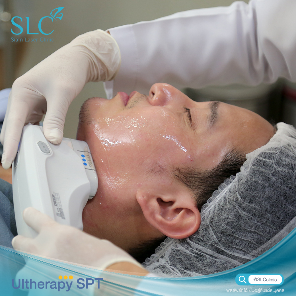 Ultherapy SPT ยกกระชับ