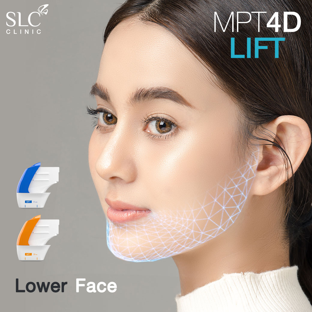 MPT4D Lift_ยกกระชับหน้า_Ultra former_Ultralift 