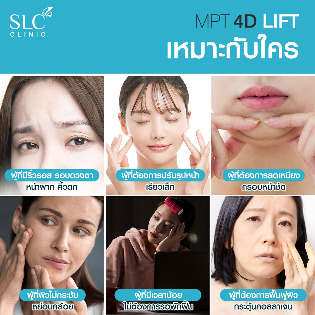 MPT4D Lift_ยกกระชับหน้า_Ultra former_Ultralift 