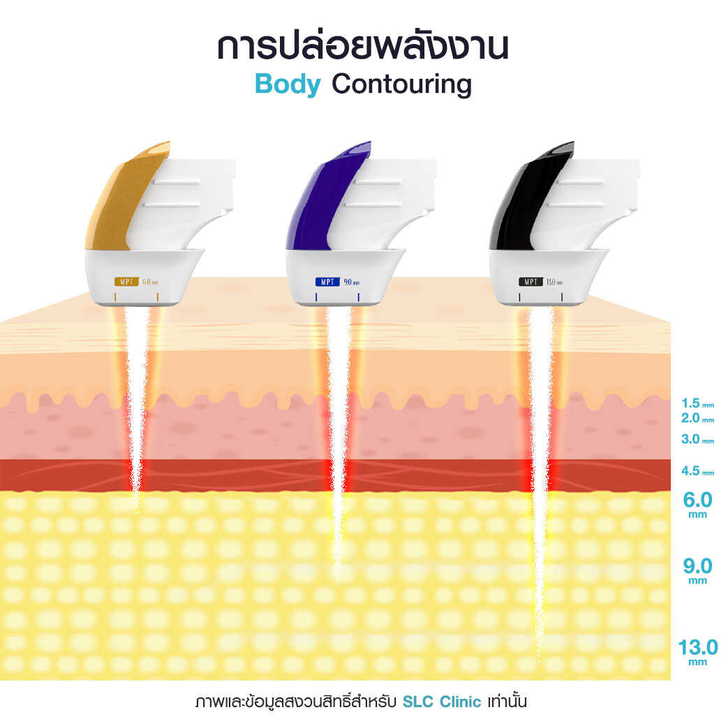  Ultralift MPT_ยกกระชับหน้า_Ultra former