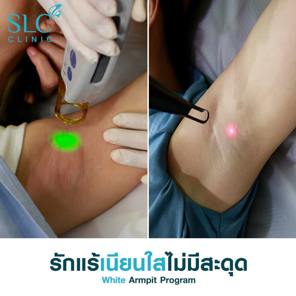 White Armpit Program_โปรแกรม รักแร้ขาว