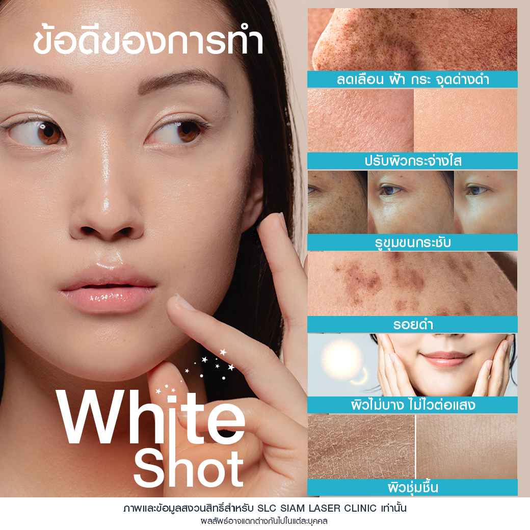 White Shot กำจัดฝ้า_รักษาฝ้า_ฉีดหน้าใส