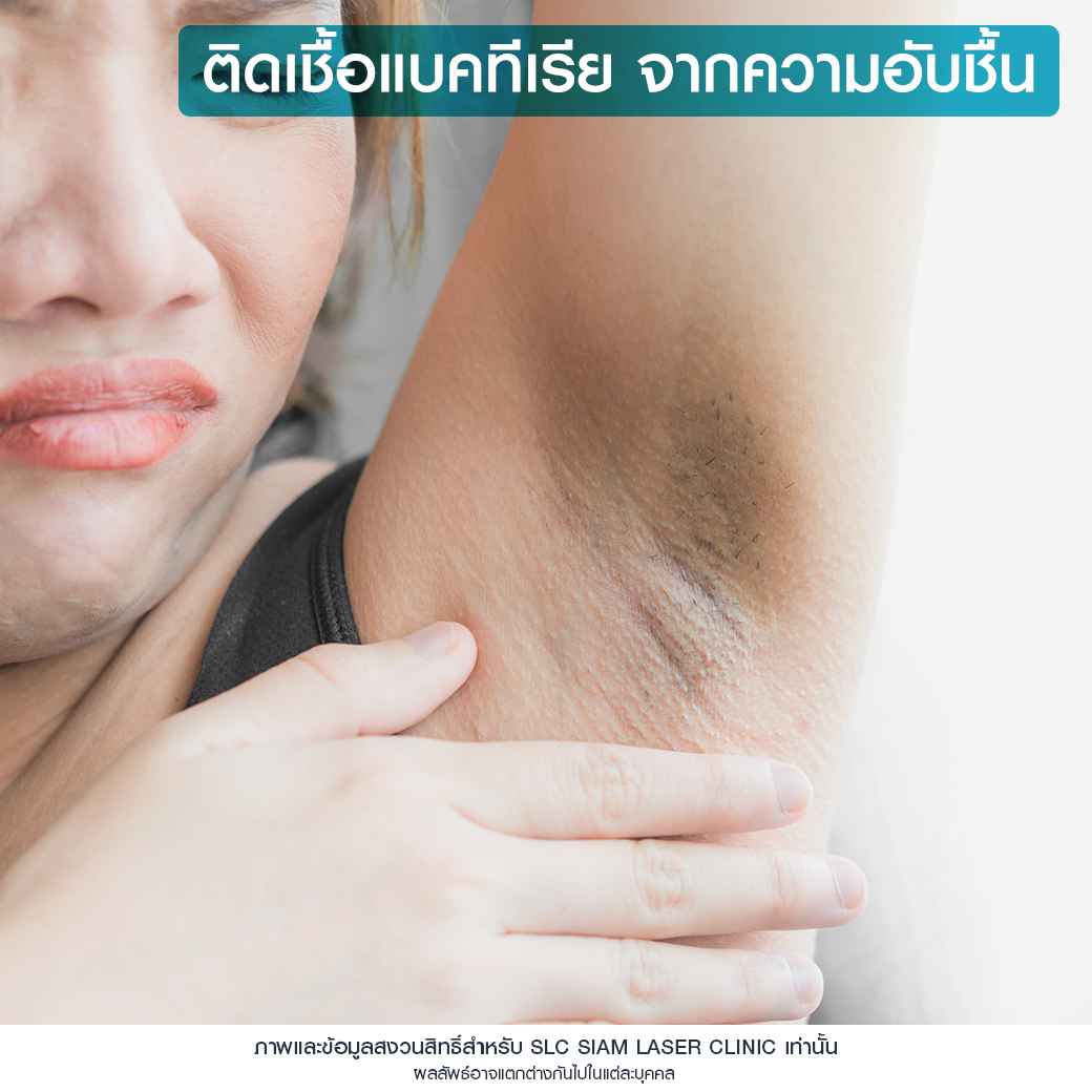 Wink Plus Armpit_โปรแกรมรักแร้ขาว