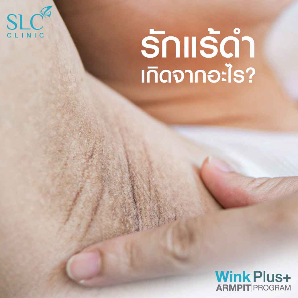 Wink Plus Armpit_โปรแกรมรักแร้ขาว