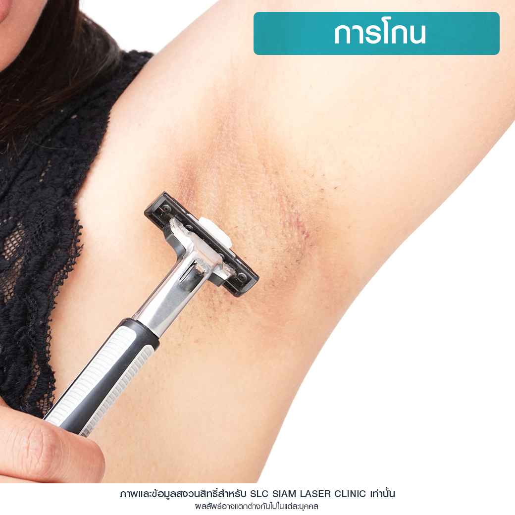 Wink Plus Armpit_โปรแกรมรักแร้ขาว