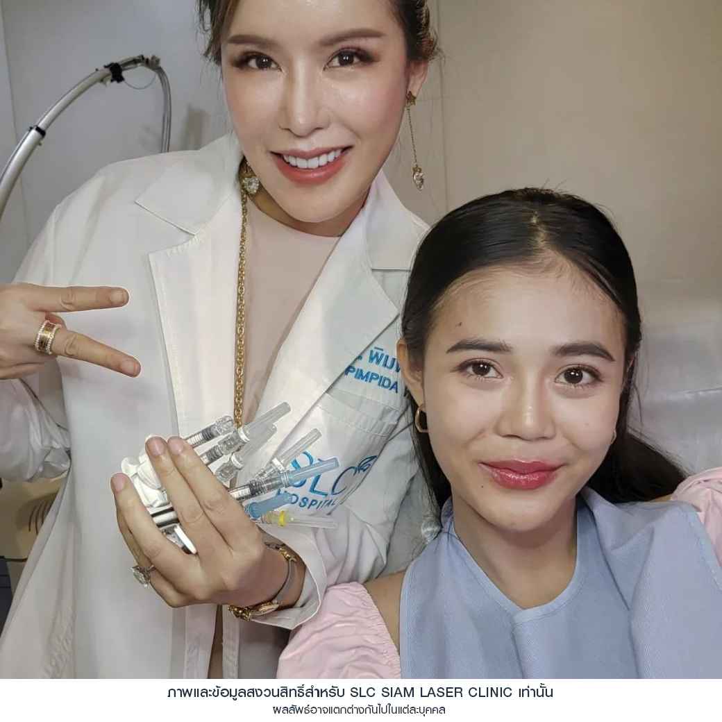 ฉีดปาก_ฟิลเลอร์_Filler Lip_ลำไย ไหทองคำ_ฉีดสารเติมเต็ม_ฉีดขมับ_ฉีดร่องแก้ม