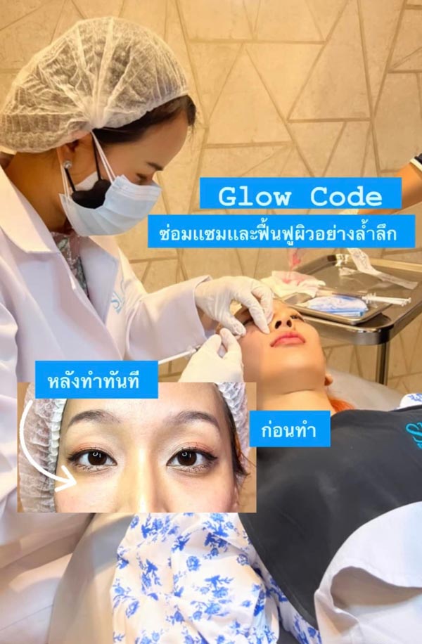  รีวิวGlow Codeกู้หน้าใส-GlowcodeSLC-ทรีทเมนท์หน้าใส