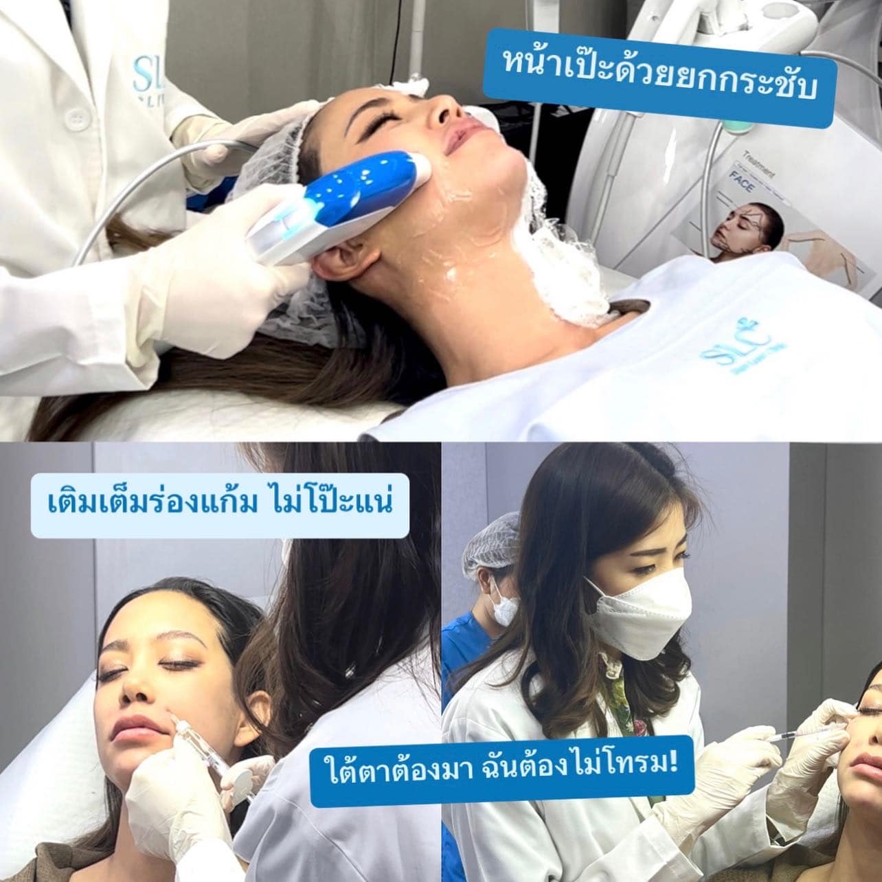 คอร์สเจ้าสาว ยกกระชับ Ultherapy แอรินแต่งงาน ฉีดปากสายฝอ เลเซอร์ขน 