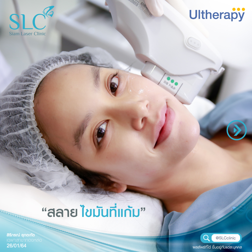 คอร์สเจ้าสาว ยกกระชับ Ultherapy แอรินแต่งงาน ฉีดปากสายฝอ เลเซอร์ขน 