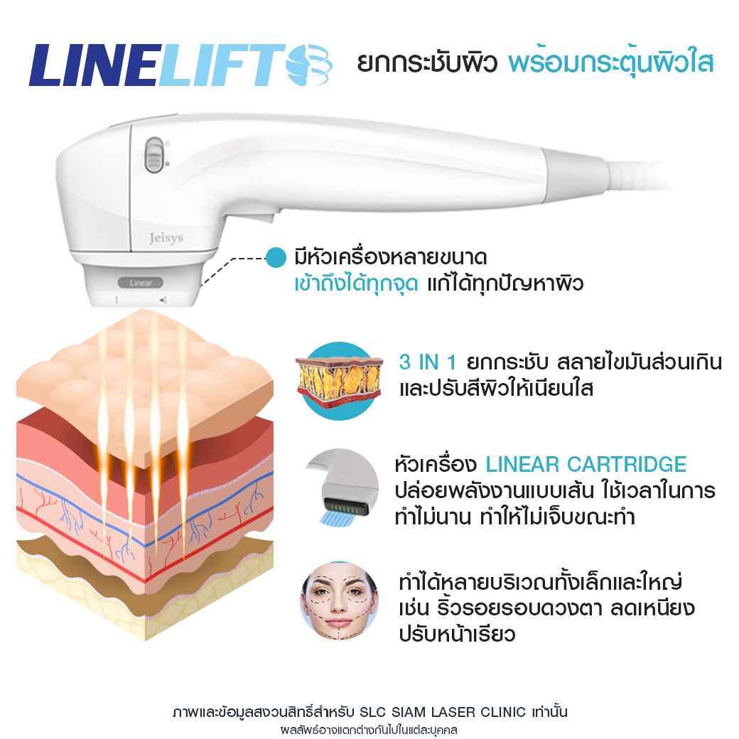 ยกกระชับ-ยกคิ้ว-ยกหน้า-รวมรีวิวยกกระชับ-รีวิวยกกระชับ-linelift