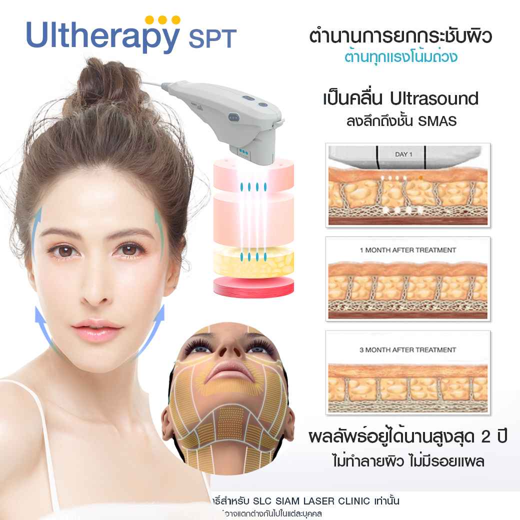 ยกกระชับ-ยกคิ้ว-ยกหน้า-รวมรีวิวยกกระชับ-รีวิวยกกระชับ-ultherapy