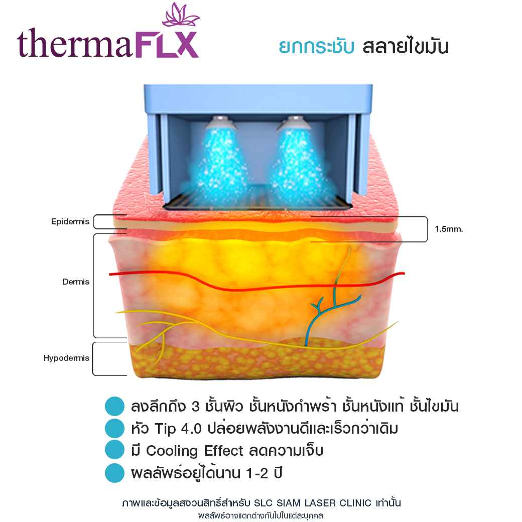 ยกกระชับ-ยกคิ้ว-ยกหน้า-รวมรีวิวยกกระชับ-รีวิวยกกระชับ-thermaFLX