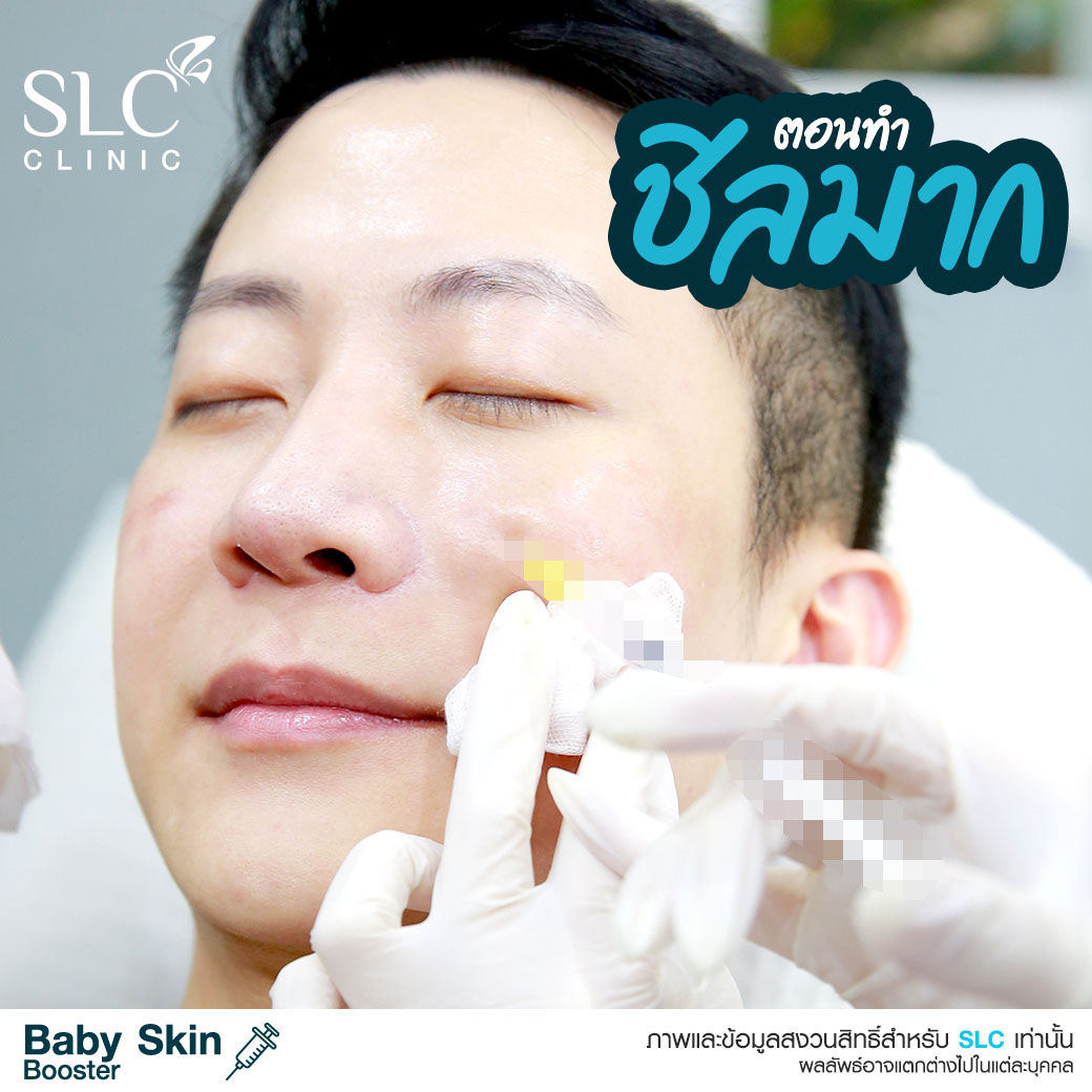  หน้าเด็ก , ผิวเด็ก , ผิวแพ้ง่าย , วิตามินบูสต์ผิวเด็ก , เอ็กโซโซม , Baby Skin Booster™  Link Brief AW : 