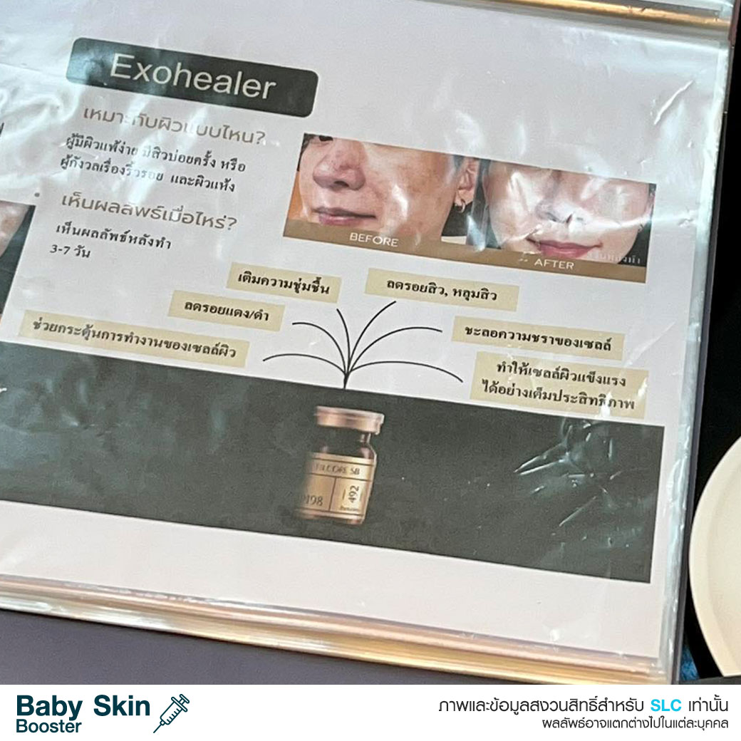  หน้าเด็ก , ผิวเด็ก , ผิวแพ้ง่าย , วิตามินบูสต์ผิวเด็ก , เอ็กโซโซม , Baby Skin Booster™  Link Brief AW : 