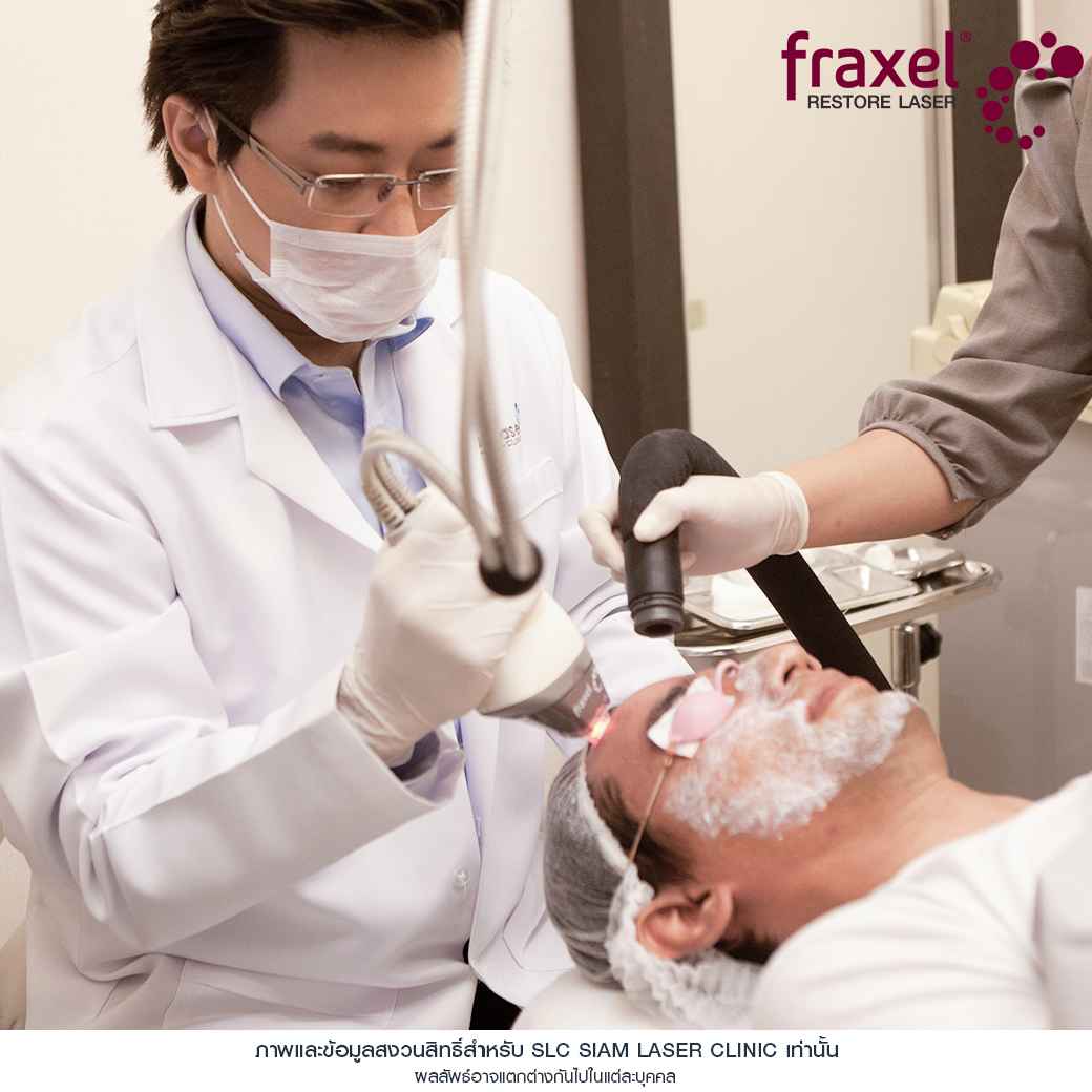 Fraxel Restore Laser_E Matrix ETWO_ acne scars_damaged skin_acne invasion