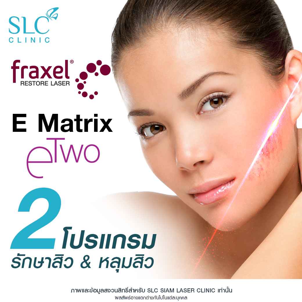 สิว_รอยหลุมสิว_รักษาสิว_Fraxel_Ematrix_เลเซอร์สิว