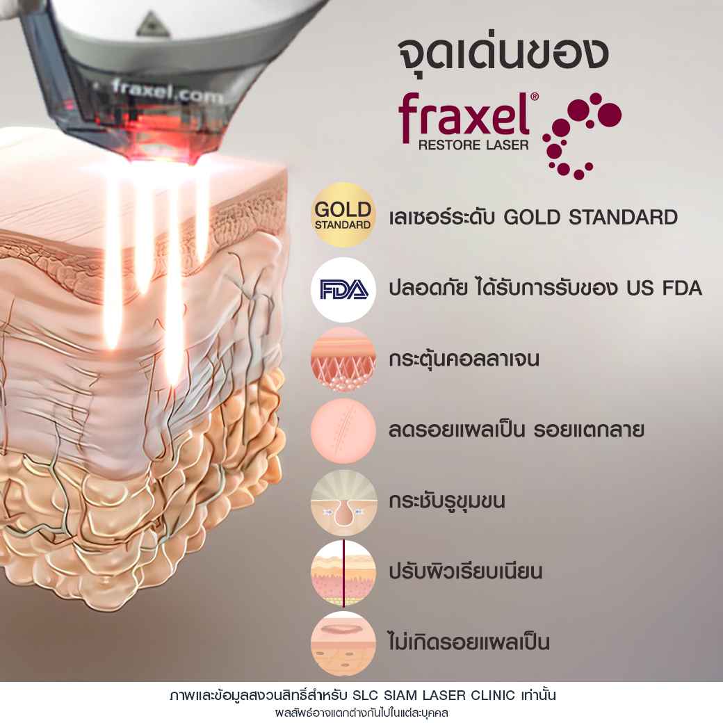 สิว_รอยหลุมสิว_รักษาสิว_Fraxel_Ematrix_เลเซอร์สิว