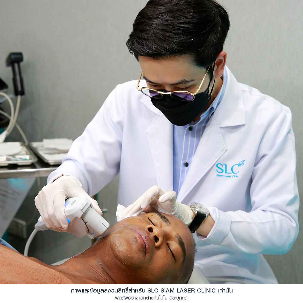 ยกกระชับ Ultherapy SPT ยกผิว ยกหน้า กระชับผิวหน้า ลดริ้วรอย หน้าเรียว ลดเหนียง รีวิวยกกระชับ