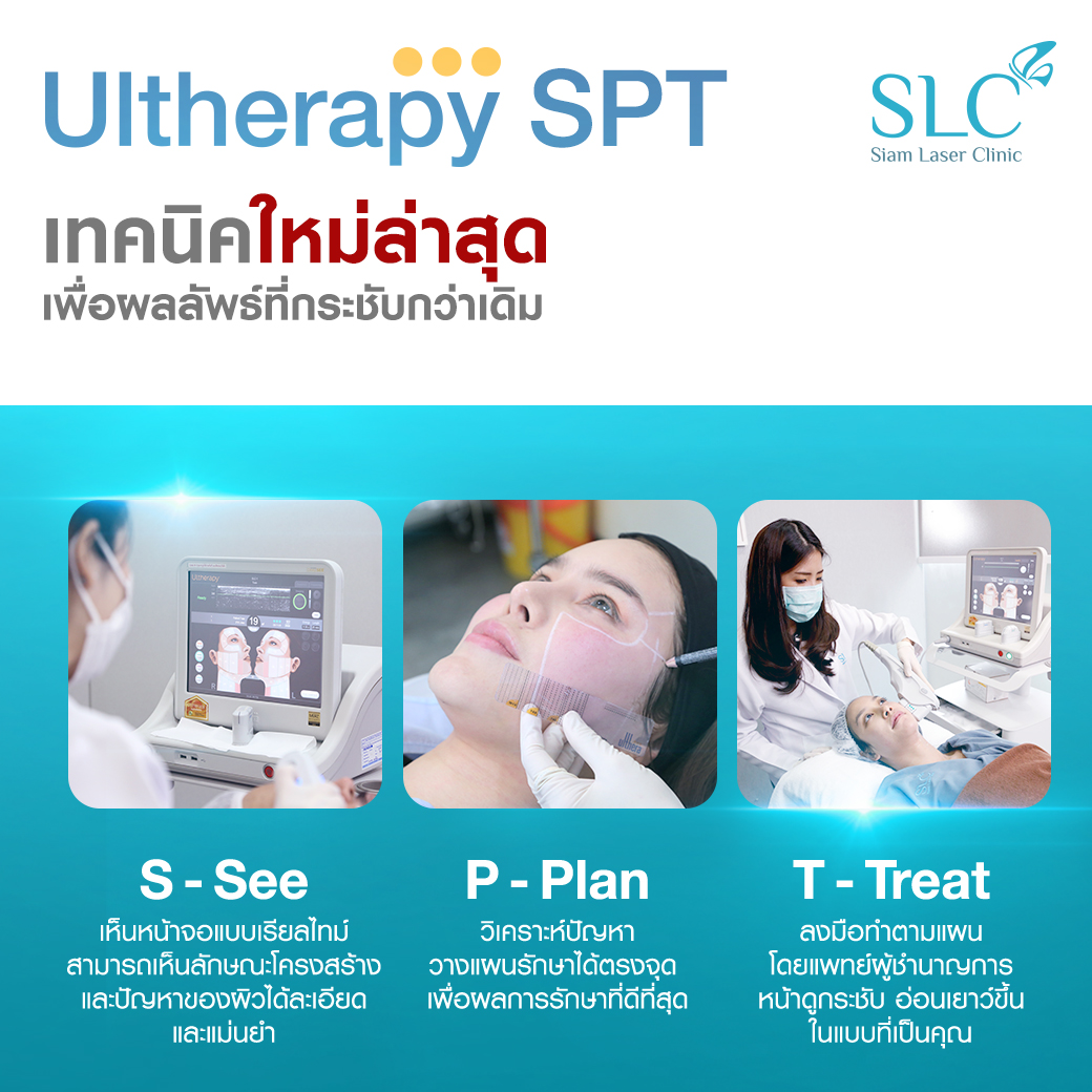 ยกกระชับ Ultherapy SPT ยกผิว ยกหน้า กระชับผิวหน้า ลดริ้วรอย หน้าเรียว ลดเหนียง รีวิวยกกระชับ